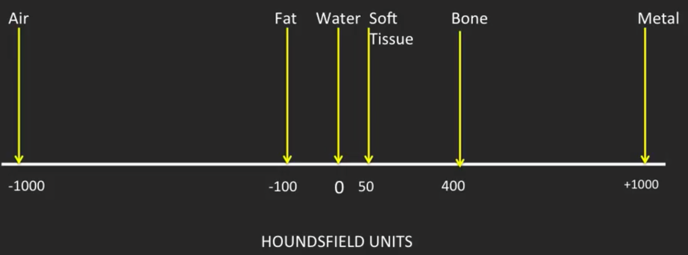 Hounsfield Scale.